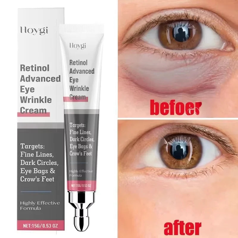 Eye Bag Removal Cream