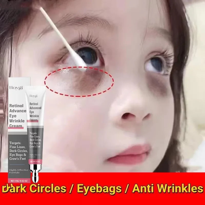 Eye Bag Removal Cream