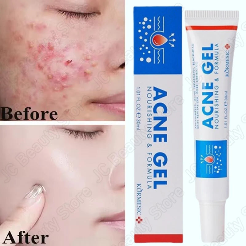 Salicylic Acid Face Cream