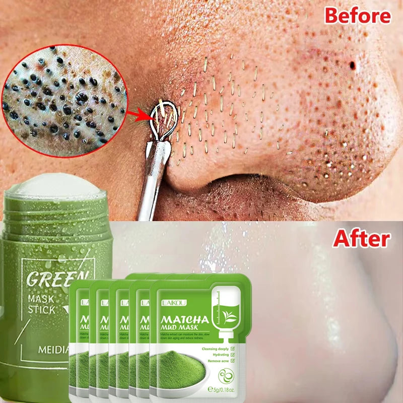 Green Tea Blackhead Removing Mask