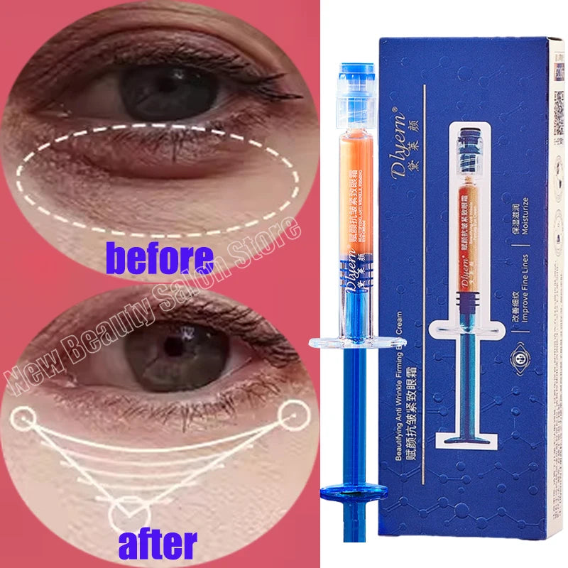 Eye Bag Removal Cream