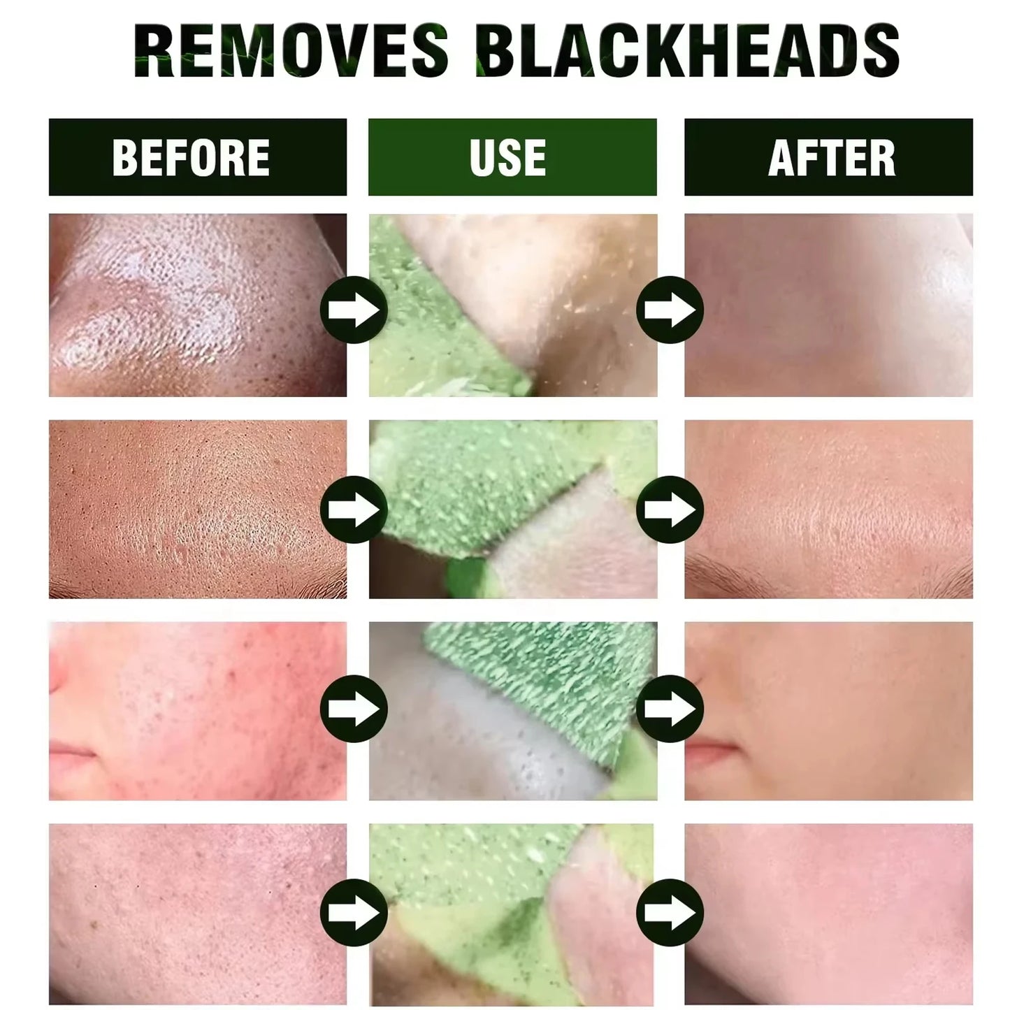 Green Tea Blackhead Removing Mask