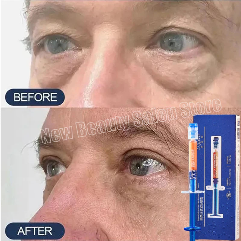 Eye Bag Removal Cream